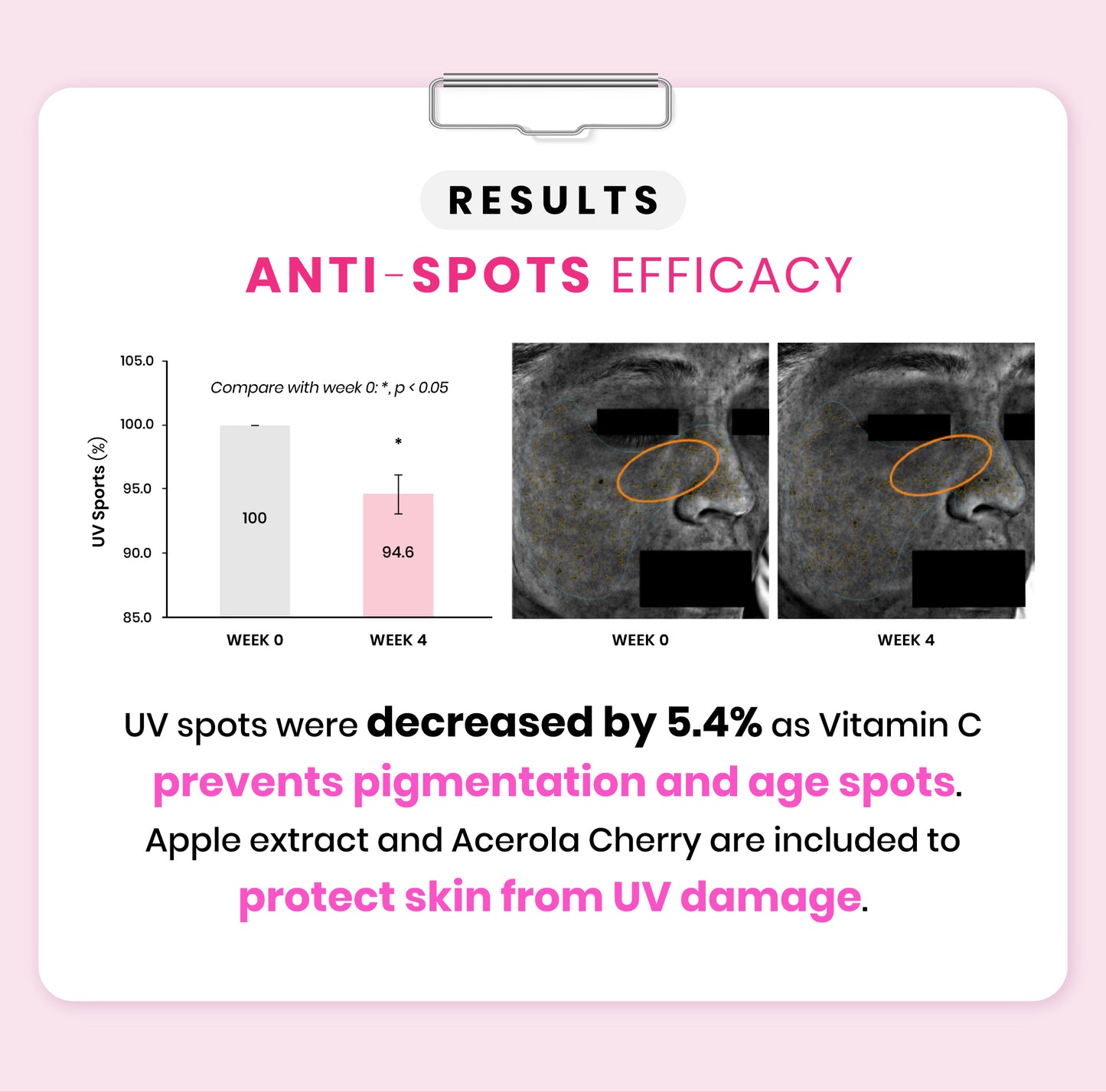 Avalon Stemcell Beauty Drink  able to reduce pigmentation and age spots. As shown, UV spots were decreased by 5.4% as Vitamin C prevents pigmentation and age spots. Apple extract and Acerola cherry are included to protect skin from UV damage. The effects can be seen within one month!