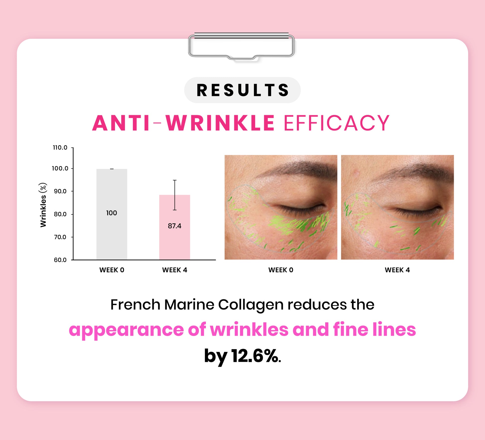 Avalon Stemcell Beauty Drink contains French Marine Collagen to reduce the appearance of wrinkles and fine lines by 12.6%.